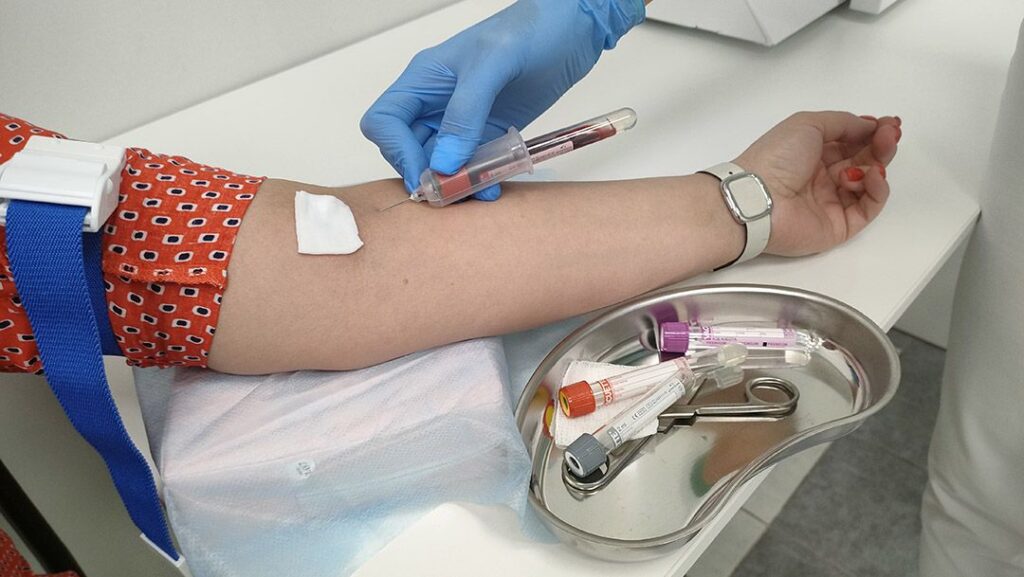 Фото 37 — Какие анализы необходимо сдать для выявления сердечно-сосудистых заболеваний