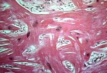 Photo of Кардиомиопатия: симптомы и лечение