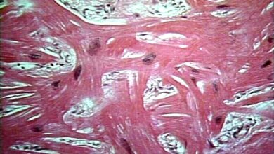 Photo of Кардиомиопатия: симптомы и лечение