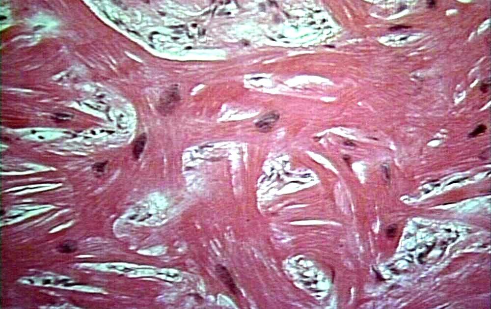 Фото 8 — Кардиомиопатия: симптомы и лечение