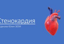 Photo of Что такое стенокардия: симптомы и лечение