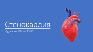 Photo of Что такое стенокардия: симптомы и лечение