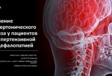 Photo of Симптомы и лечение гипертонического криза