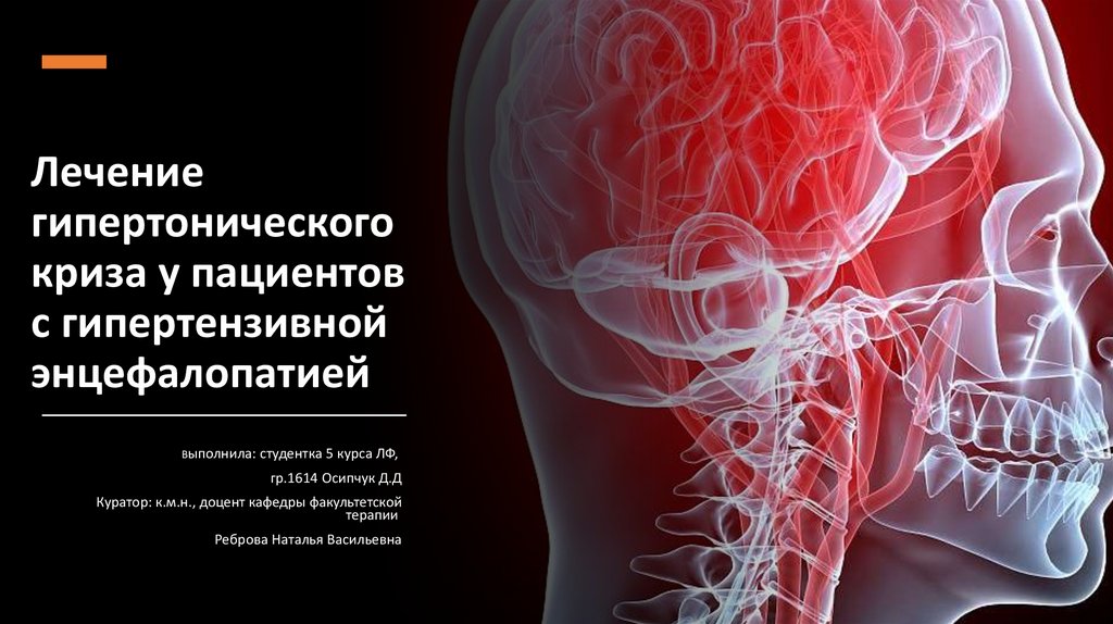 Фото 36 — Симптомы и лечение гипертонического криза