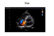 Photo of Польза орехов для сердечно-сосудистой системы