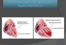 Photo of Признаки сердечной недостаточности: как их распознать