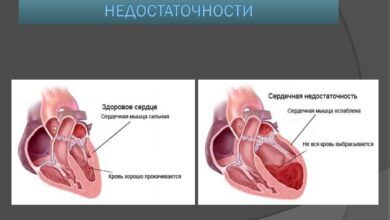 Photo of Признаки сердечной недостаточности: как их распознать