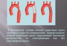 Photo of рожденные пороки сердца: особенности диагностики у детей