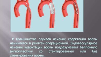 Photo of рожденные пороки сердца: особенности диагностики у детей